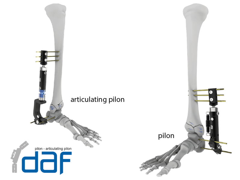 Pilon-Articulating Pilon Fixator – TST