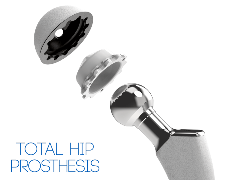 Press Fit Cup (Cementless Total Hip Replacement) TST